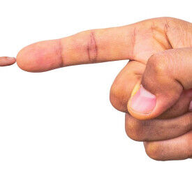 Umgang mit Machtmenschen, Narzissten und dominanten Menschen